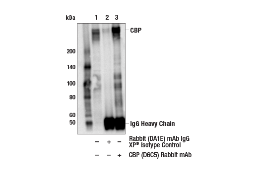  Image 31: PPARγ Regulated Fatty Acid Metabolism Antibody Sampler Kit