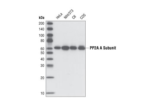 Western Blotting Image 1: PP2A A Subunit (81G5) Rabbit mAb (BSA and Azide Free)