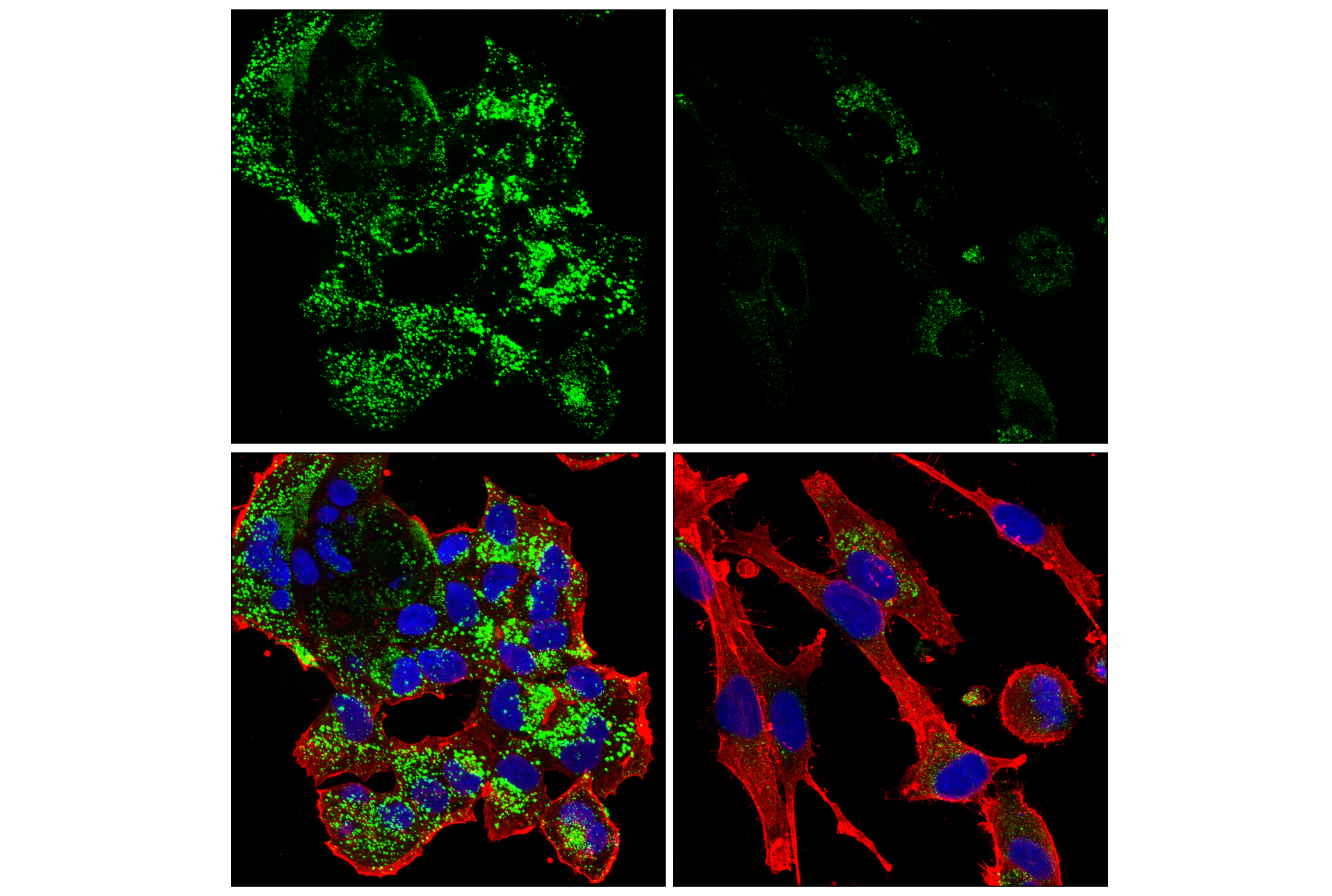 Immunofluorescence Image 5: Cathepsin D (E5V4H) Rabbit mAb