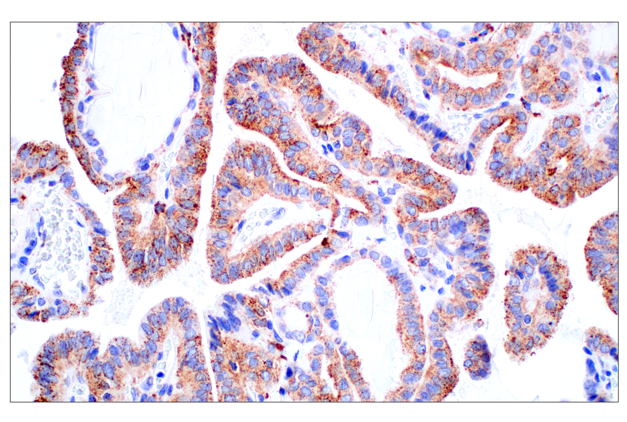 Immunohistochemistry Image 2: Cathepsin D (E5V4H) Rabbit mAb