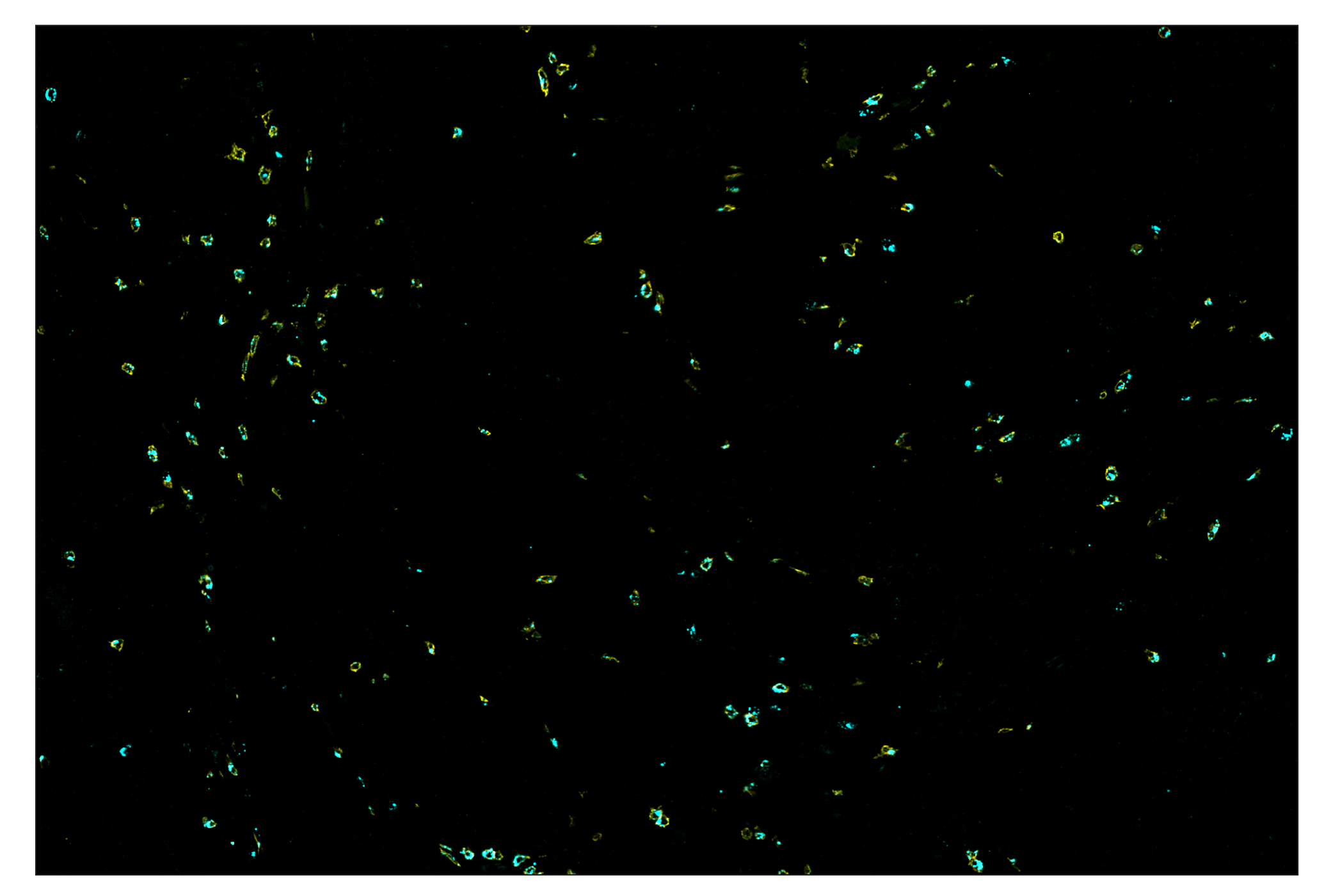 Immunohistochemistry Image 8: Granzyme B (D6E9W) & CO-0009-488 SignalStar™ Oligo-Antibody Pair