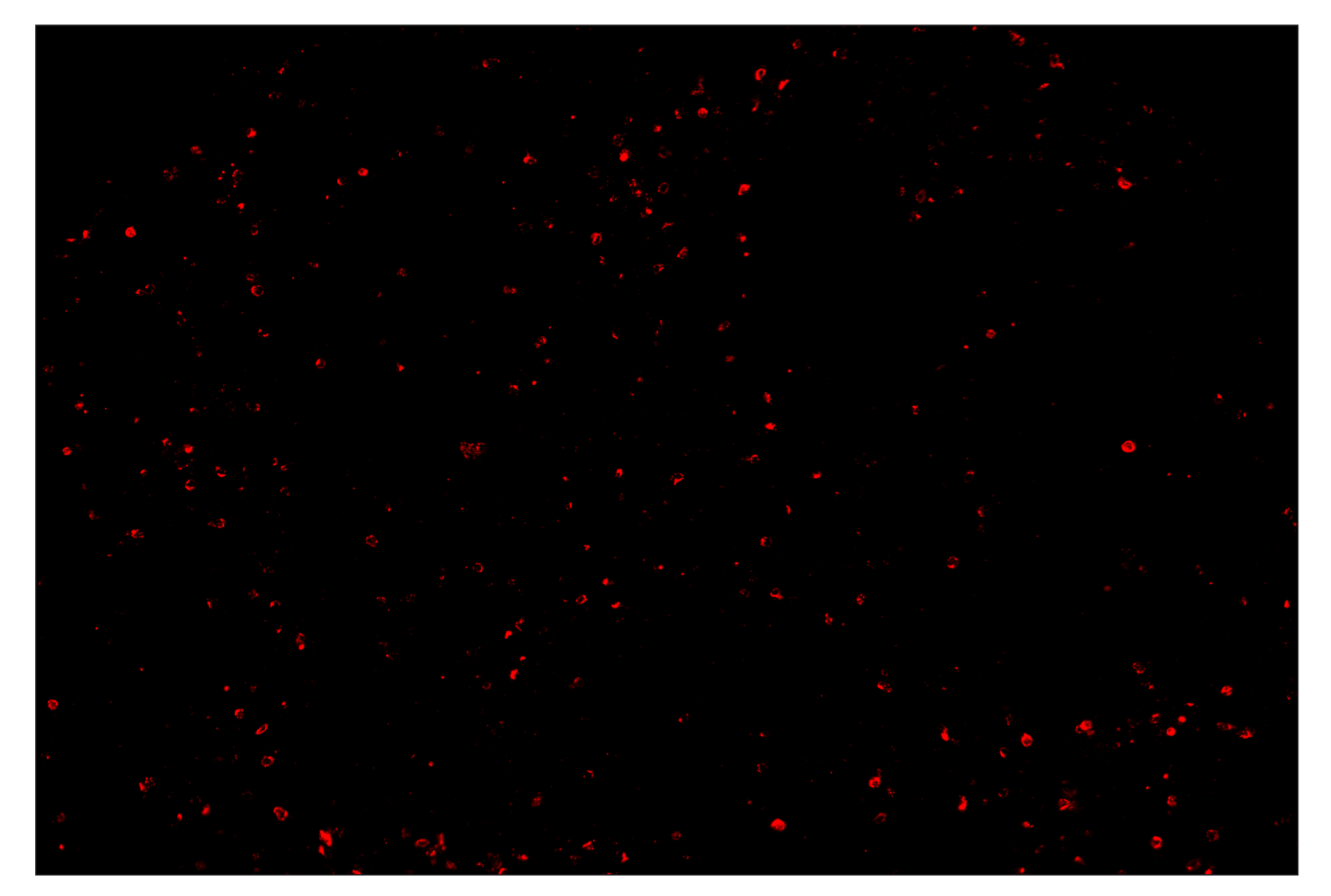 Immunohistochemistry Image 4: Granzyme B (D6E9W) & CO-0009-750 SignalStar™ Oligo-Antibody Pair