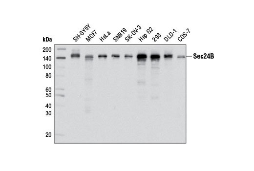 Western Blotting Image 1: Sec24B Antibody