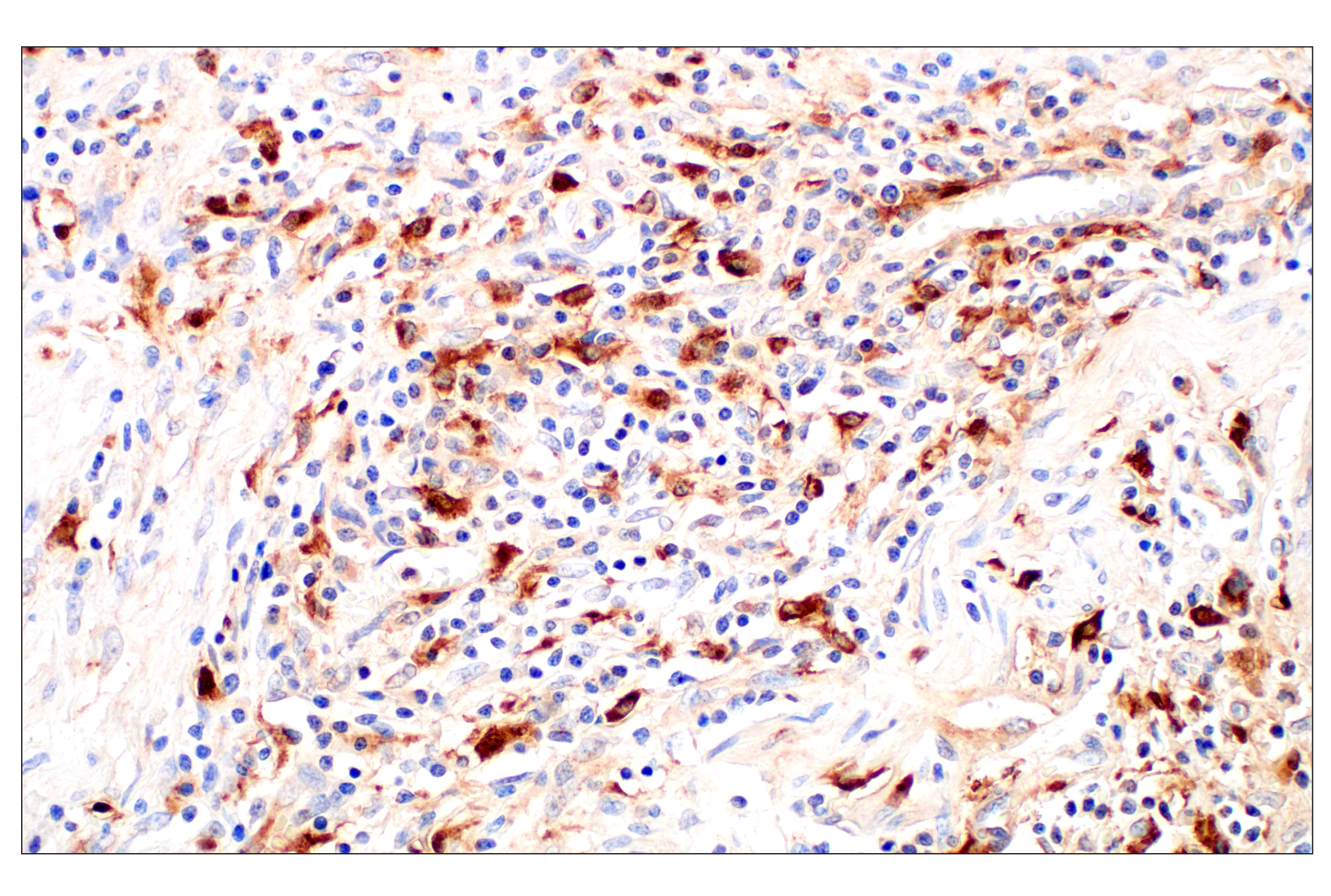 Immunohistochemistry Image 6: Cathepsin L (E3R3P) Rabbit mAb (BSA and Azide Free)
