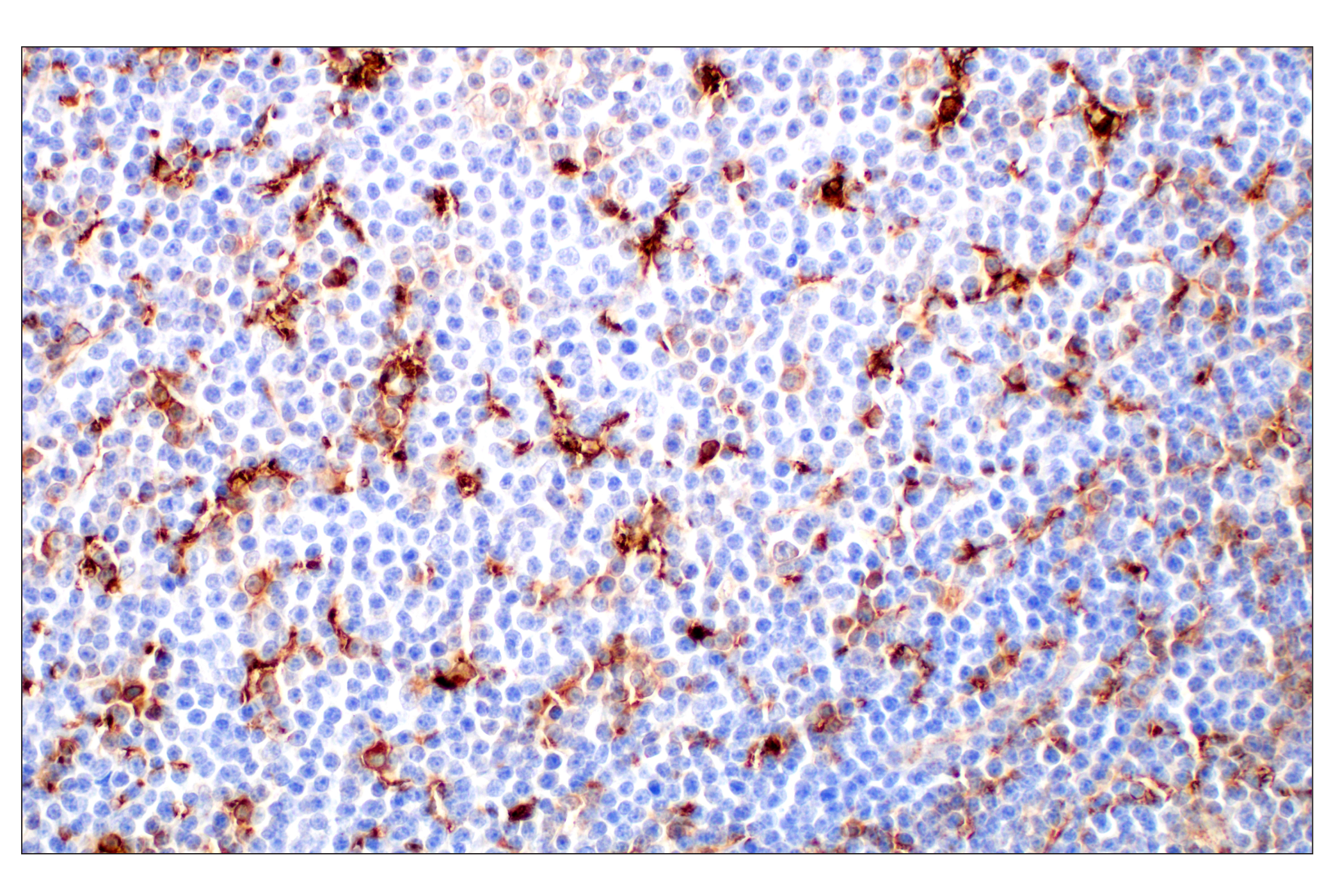 Immunohistochemistry Image 4: Cathepsin L (E3R3P) Rabbit mAb (BSA and Azide Free)
