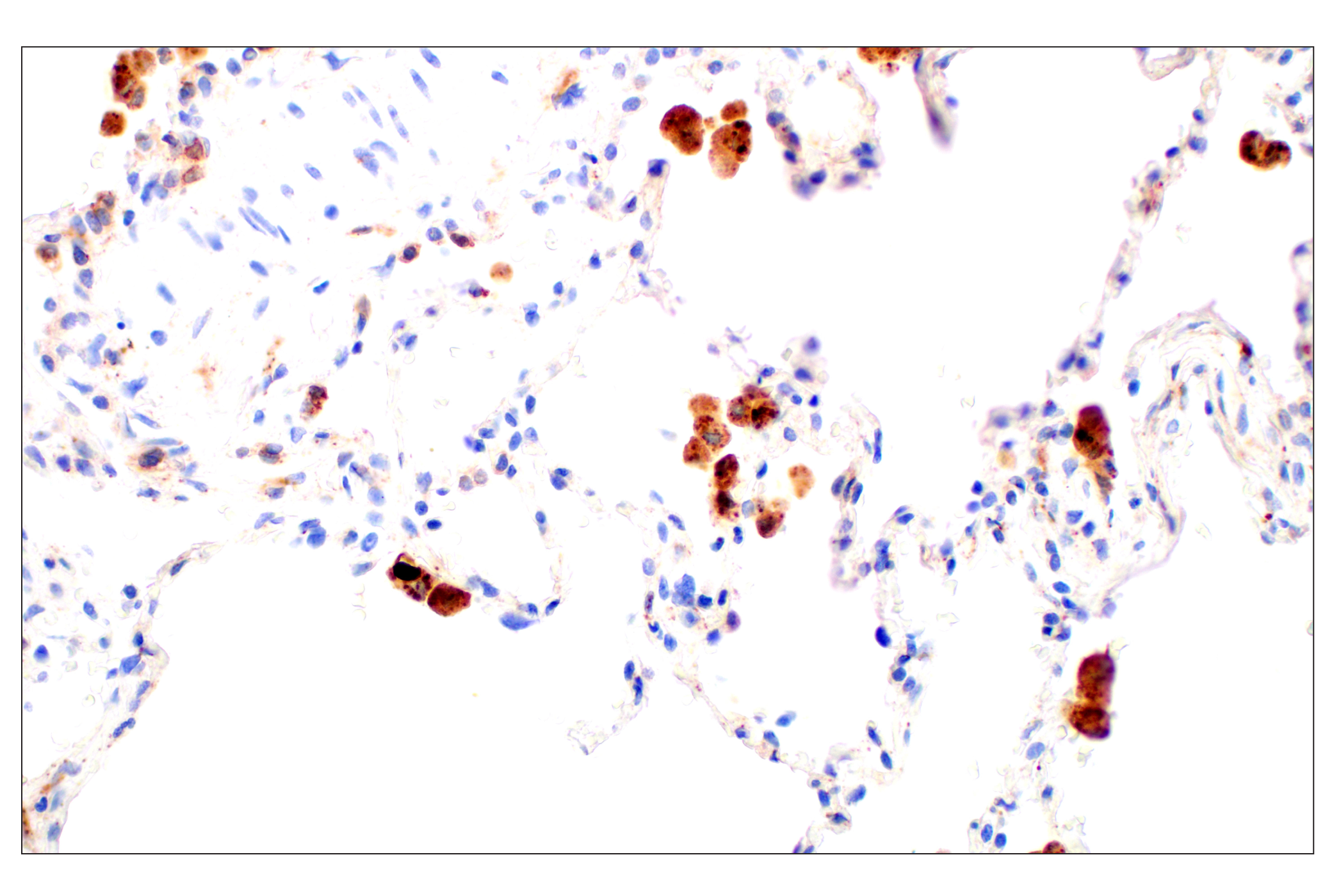 Immunohistochemistry Image 12: Cathepsin L (E3R3P) Rabbit mAb (BSA and Azide Free)