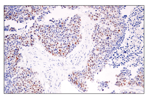 Immunohistochemistry Image 1: p14 ARF (E3X6D) Rabbit mAb