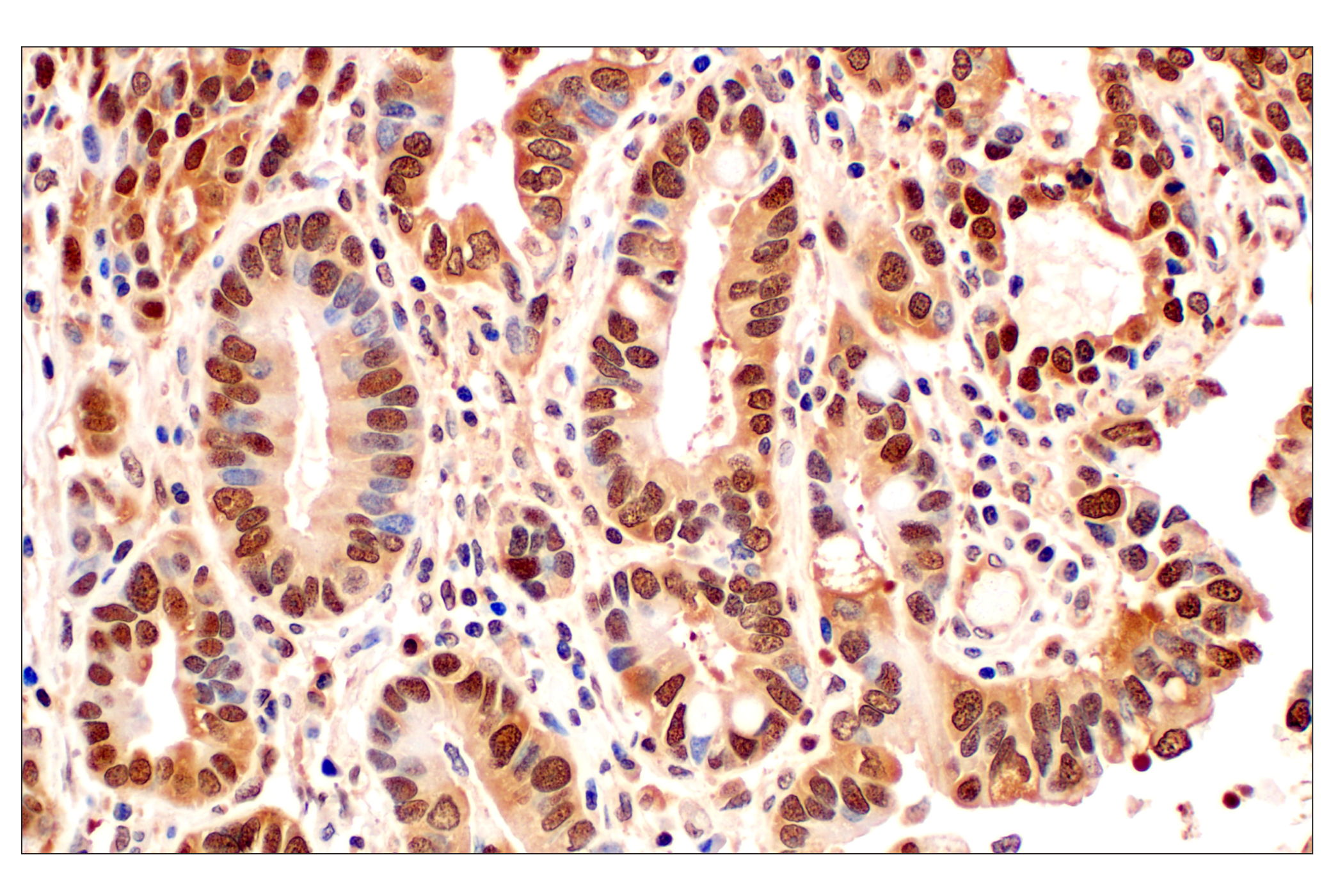 Immunohistochemistry Image 1: MTAP (E5R1I) Rabbit mAb