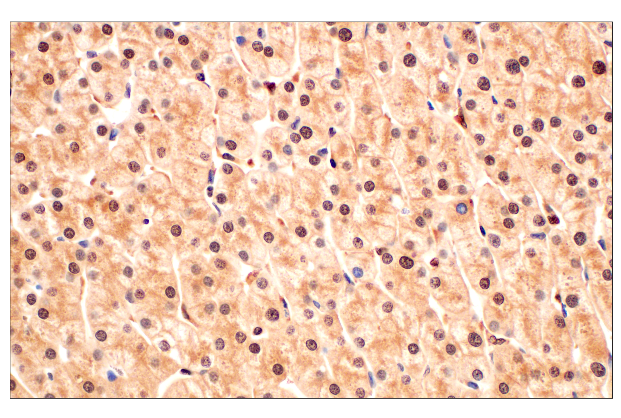 Immunohistochemistry Image 5: MTAP (E5R1I) Rabbit mAb
