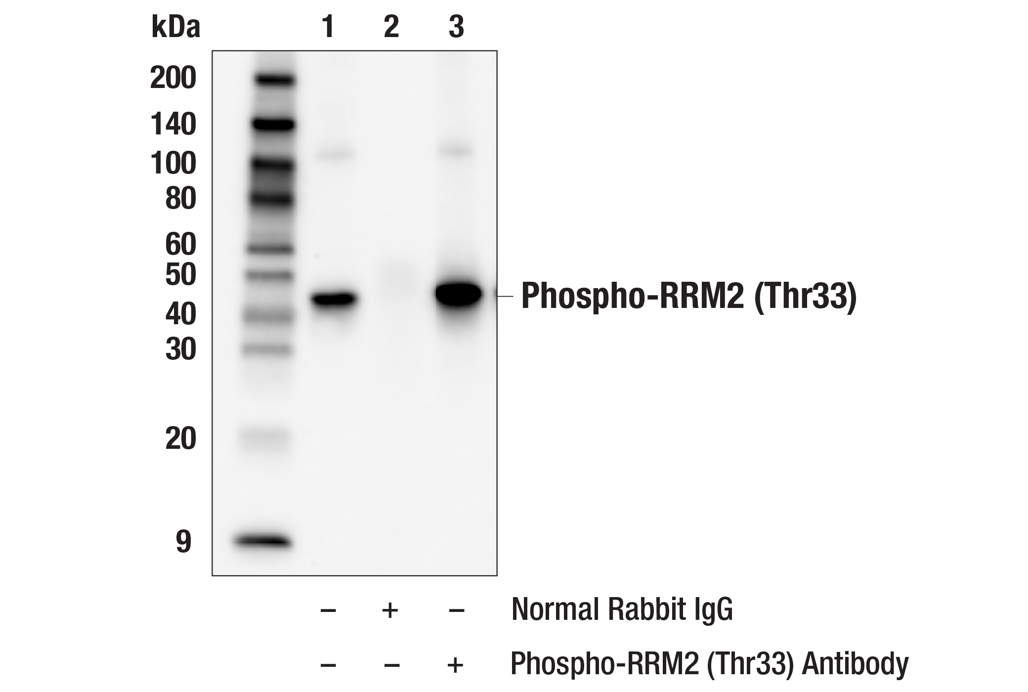 Immunoprecipitation Image 1: Phospho-RRM2 (Thr33) Antibody