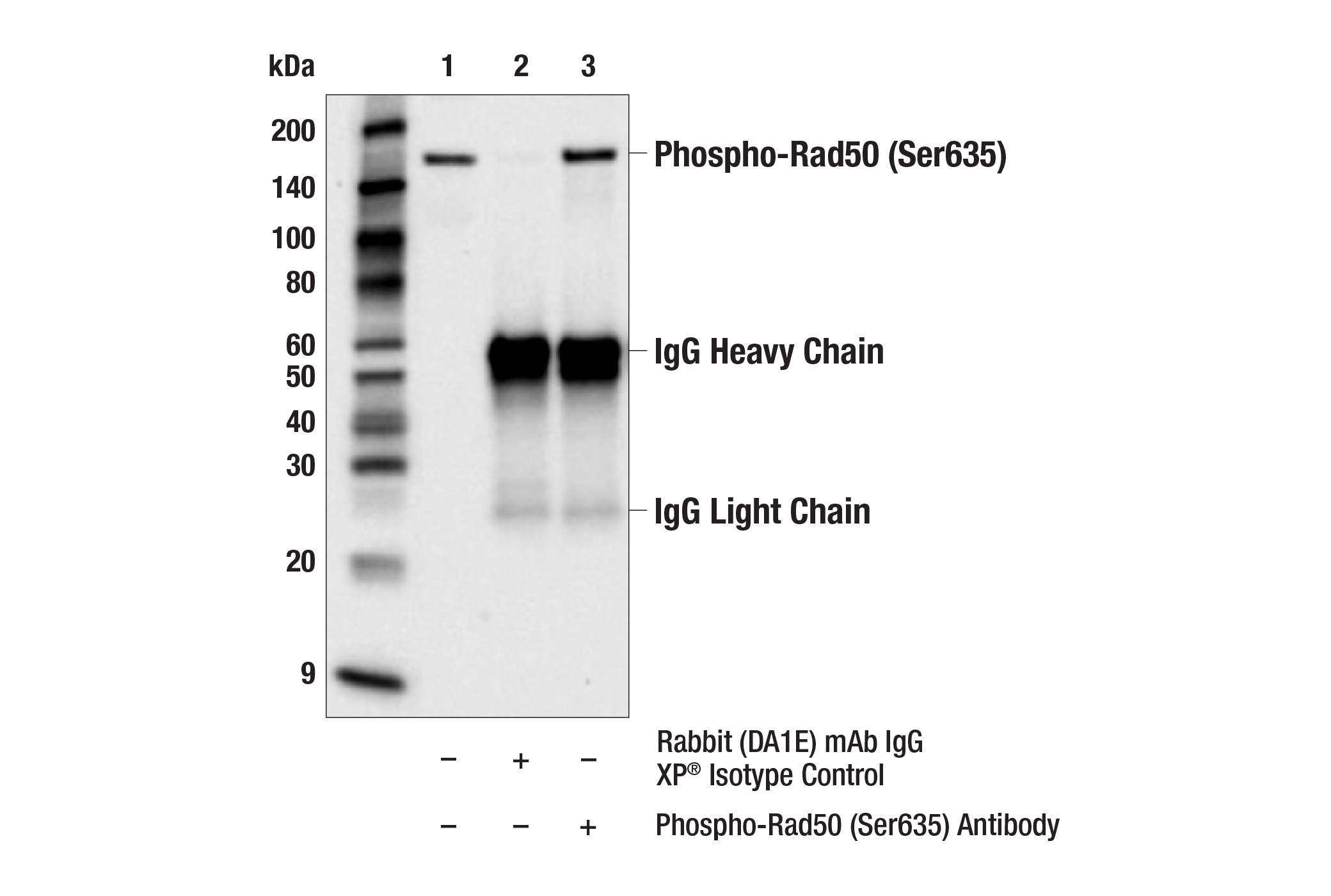 Immunoprecipitation Image 1: Phospho-Rad50 (Ser635) Antibody