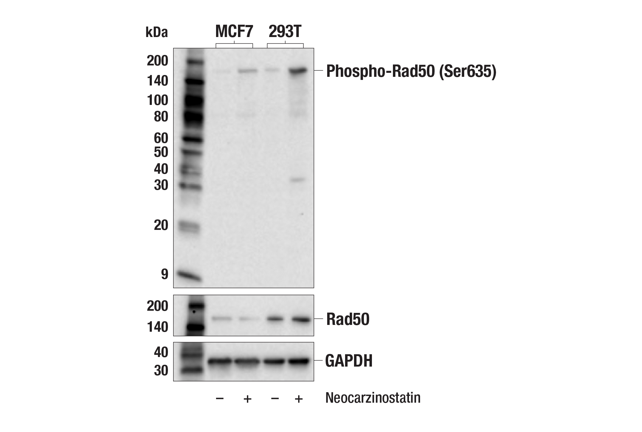 Western Blotting Image 2: Phospho-Rad50 (Ser635) Antibody