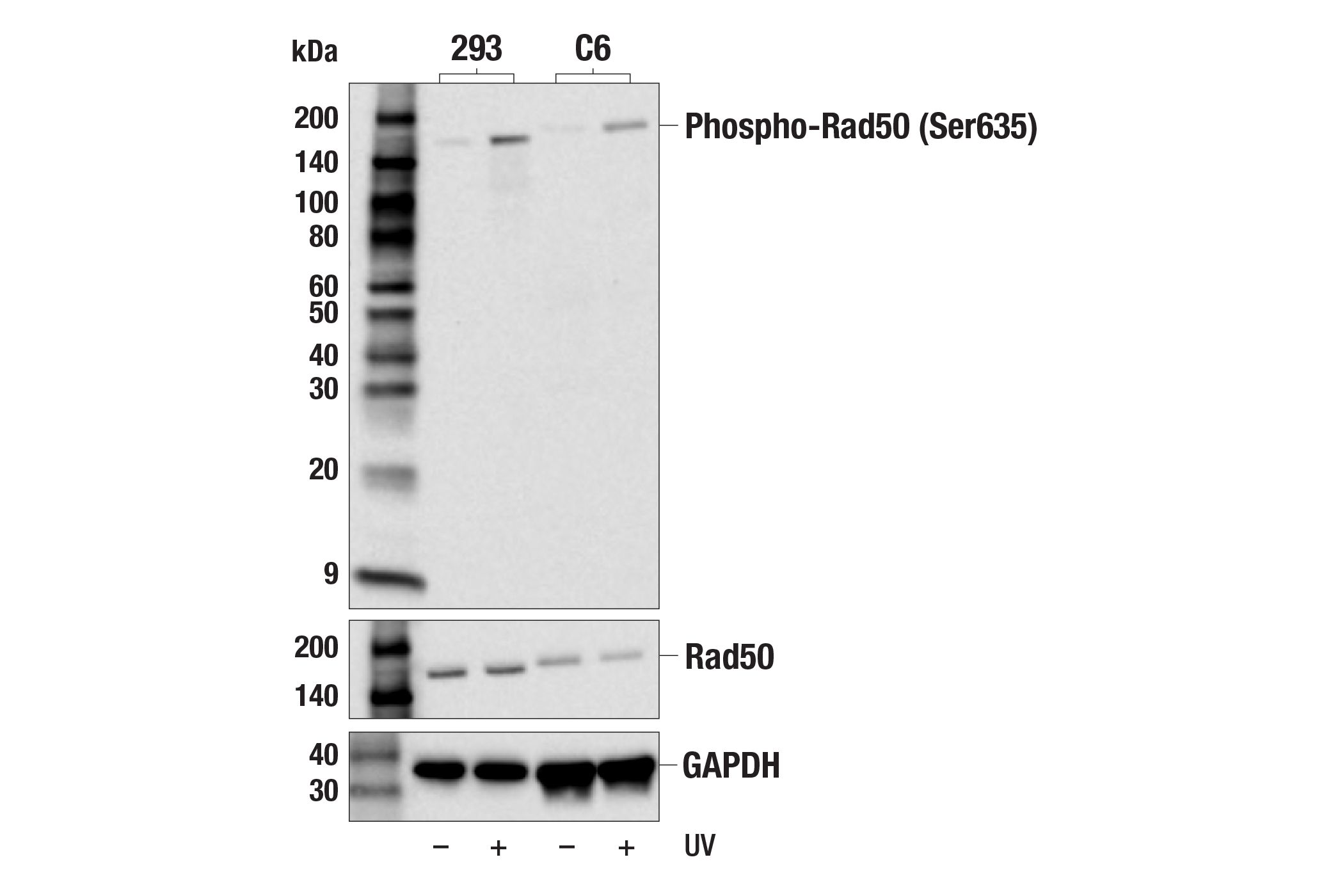 Western Blotting Image 1: Phospho-Rad50 (Ser635) Antibody