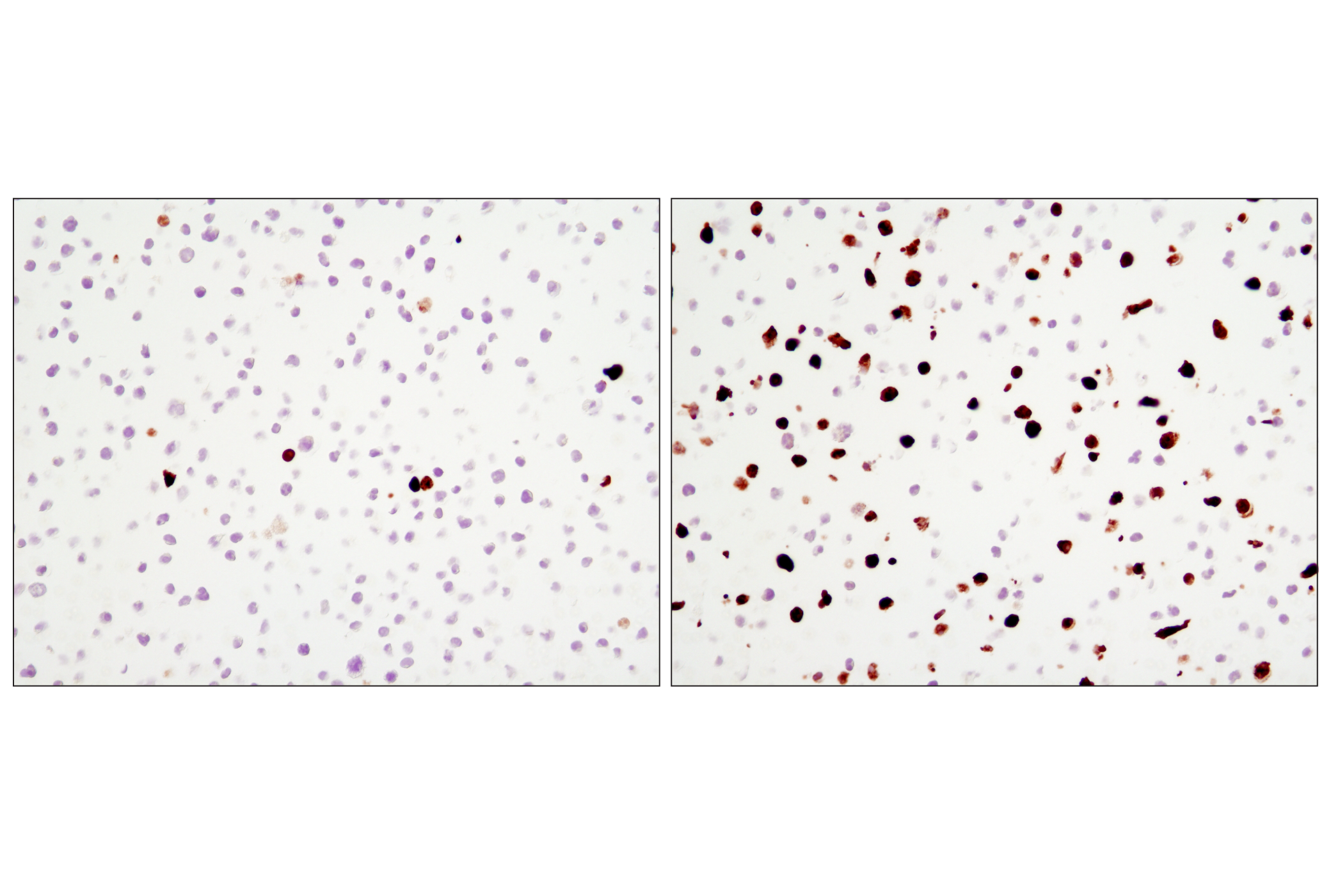 Immunohistochemistry Image 1: Cleaved Caspase-3 (Asp175) (D3E9) Rabbit mAb (BSA and Azide Free)