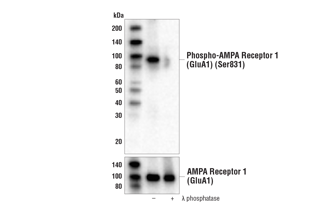  Image 22: ApoE Synaptic Formation and Signaling Pathway Antibody Sampler Kit