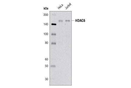  Image 5: Class II HDAC Antibody Sampler Kit