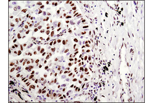 Immunohistochemistry Image 1: HSF1 (D3L8I) Rabbit mAb (BSA and Azide Free)