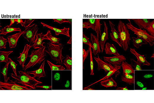 Immunofluorescence Image 1: HSF1 (D3L8I) Rabbit mAb (BSA and Azide Free)
