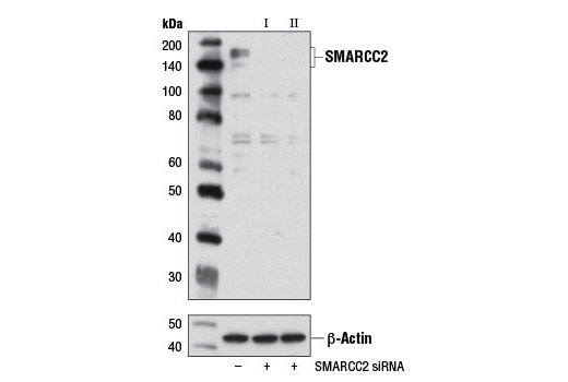  Image 1: SignalSilence® SMARCC2 siRNA II