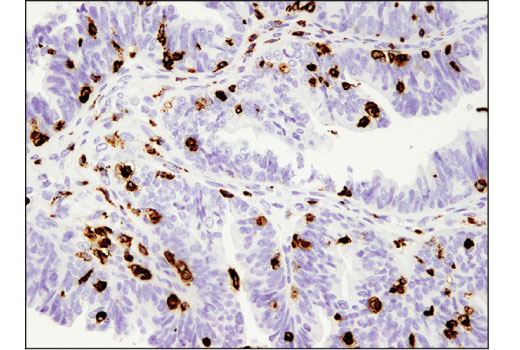 Immunohistochemistry Image 3: CD68 (D4B9C) XP® Rabbit mAb