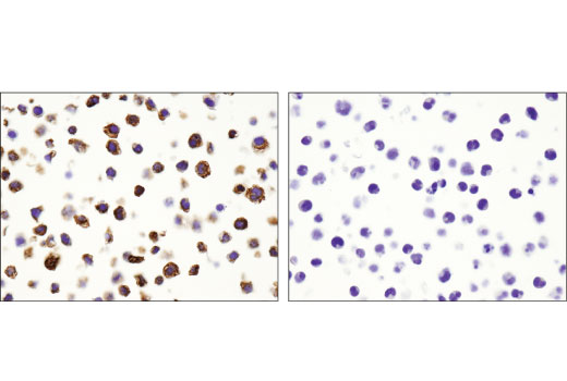  Image 47: Human Reactive M1 vs M2 Macrophage IHC Antibody Sampler Kit