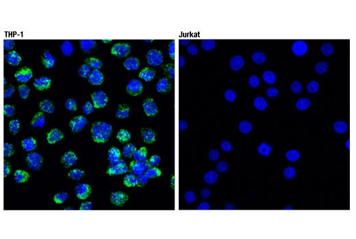  Image 53: Human Reactive M1 vs M2 Macrophage IHC Antibody Sampler Kit