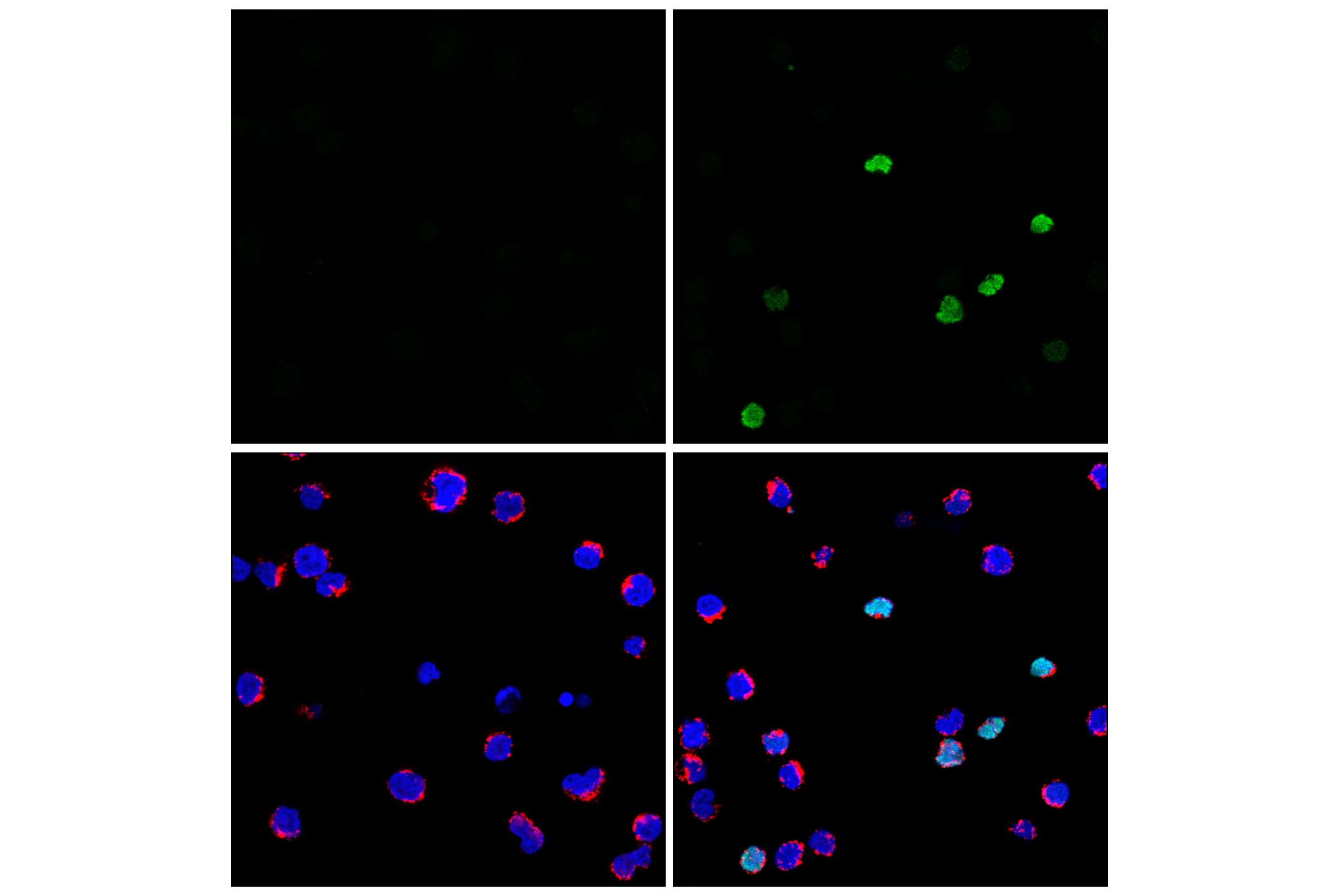 Immunofluorescence Image 1: PADI4 (F1B9L) Rabbit mAb