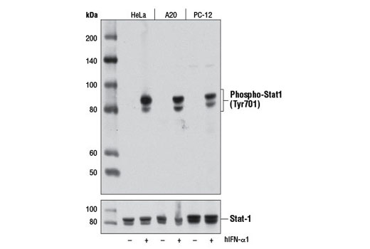  Image 14: IFN (Type I/III) Signaling Pathway Antibody Sampler Kit