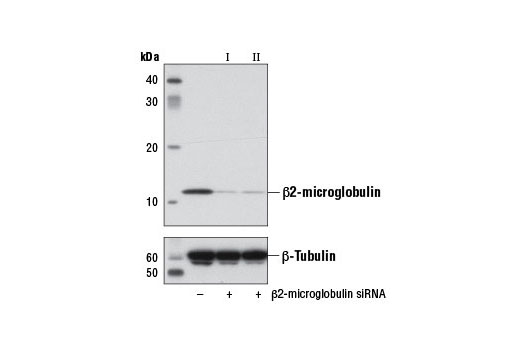  Image 1: SignalSilence® β2-microglobulin siRNA I