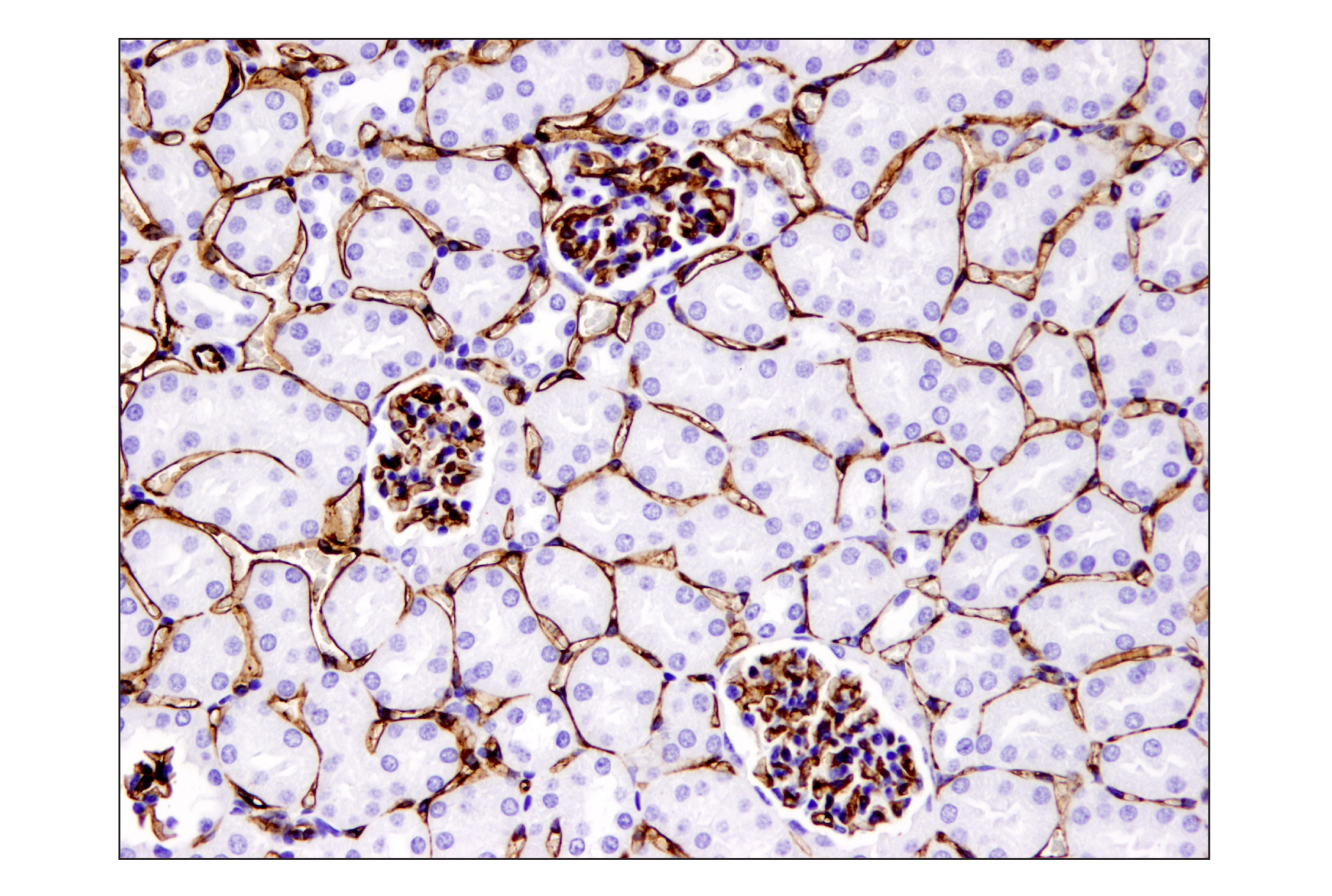 Immunohistochemistry Image 2: CD31 (PECAM-1) (D8V9E) XP® Rabbit mAb