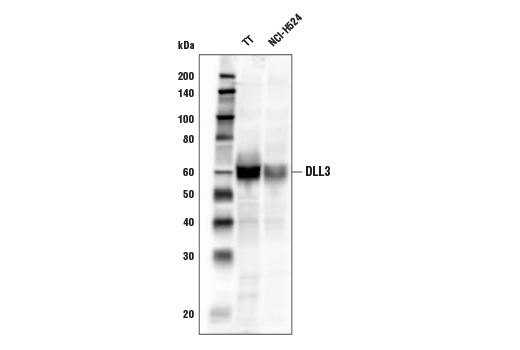 Western Blotting Image 1: DLL3 Antibody