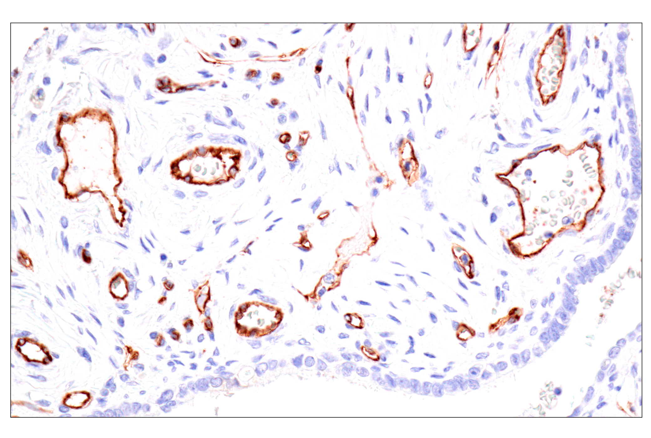 Immunohistochemistry Image 2: Claudin-5 (E5D9Y) Rabbit mAb (BSA and Azide Free)