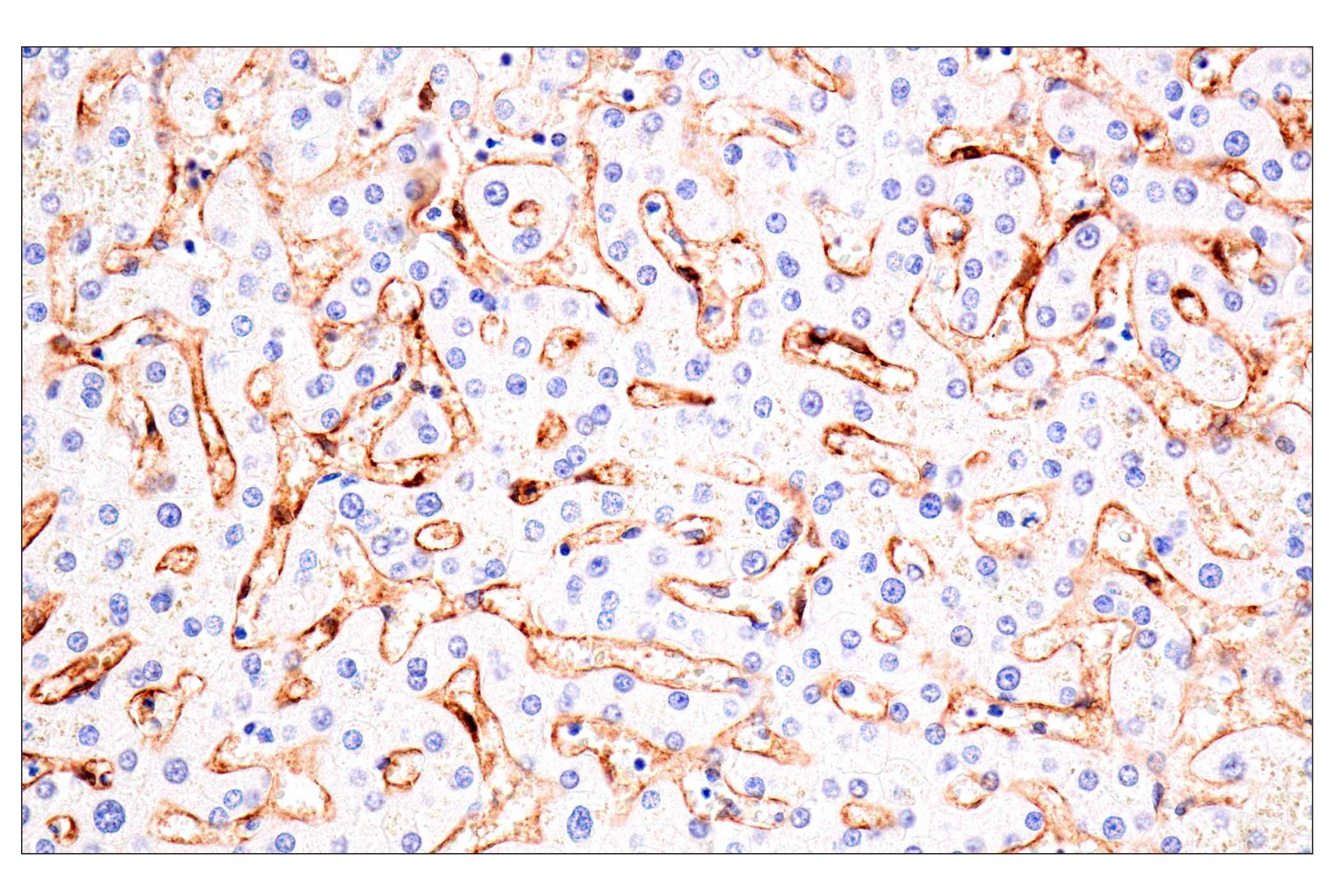 Immunohistochemistry Image 5: Claudin-5 (E5D9Y) Rabbit mAb (BSA and Azide Free)