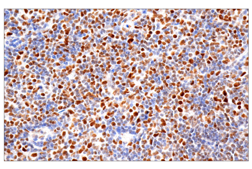 Immunohistochemistry Image 1: PMS2 (M0R4G) Mouse mAb