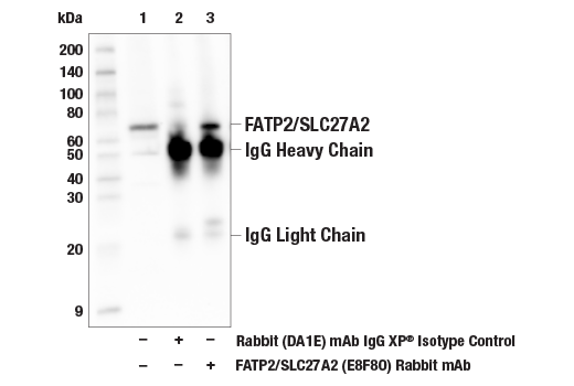 Immunoprecipitation Image 1: FATP2/SLC27A2 (E8F8O) Rabbit mAb