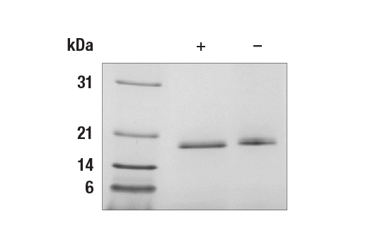 Image 1: Human IL-1RA Recombinant Protein