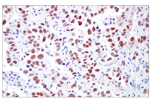 Immunohistochemistry Image 5: TIF1α/TRIM24 (E9T3N) Rabbit mAb