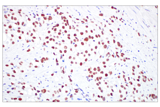 Immunohistochemistry Image 6: TIF1α/TRIM24 (E9T3N) Rabbit mAb
