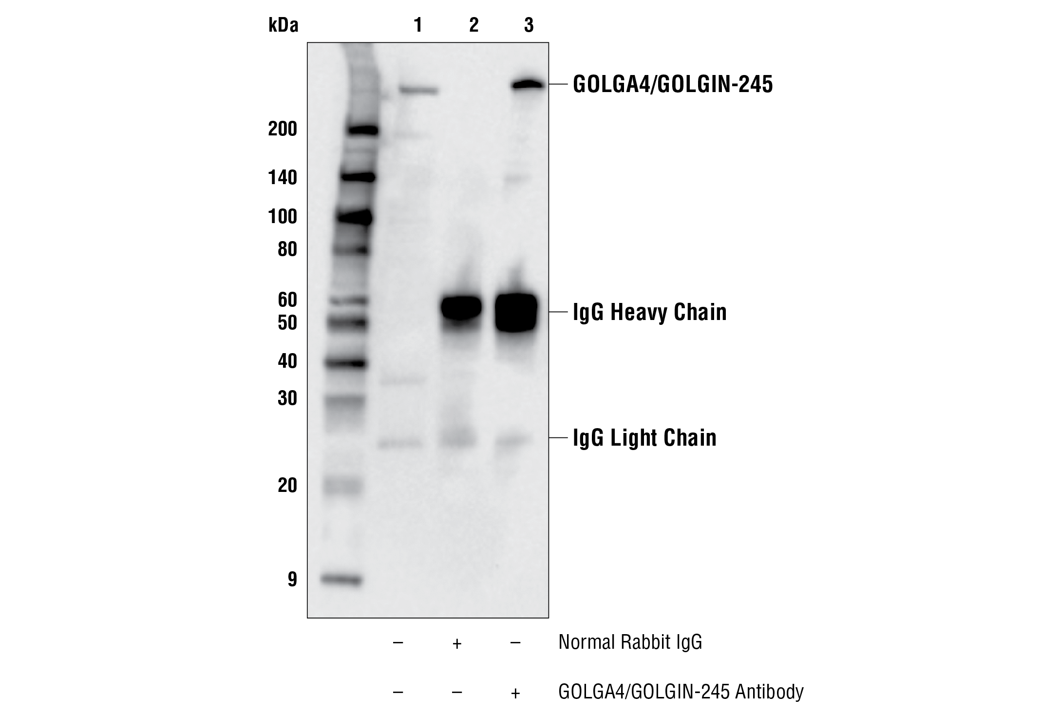 Immunoprecipitation Image 1: GOLGA4/GOLGIN-245 Antibody