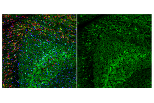 Immunofluorescence Image 3: Neurogranin (E9L8D) Rabbit mAb