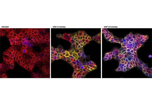 Immunofluorescence Image 2: PathScan® EGF Receptor Activation Multiplex IF Kit