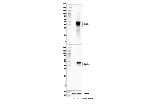  Image 22: MHC Class I Antigen Processing and Presentation Antibody Sampler Kit