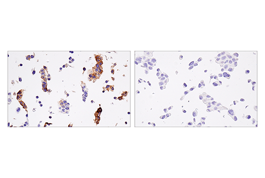  Image 29: MHC Class I Antigen Processing and Presentation Antibody Sampler Kit