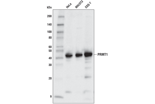  Image 8: PRMT Antibody Sampler Kit