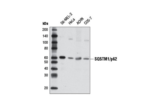  Image 10: SQSTM1/p62-like Receptor Antibody Sampler Kit