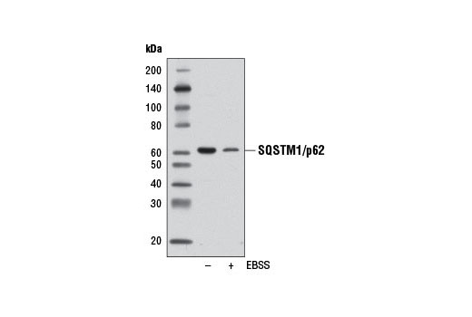  Image 12: SQSTM1/p62-like Receptor Antibody Sampler Kit
