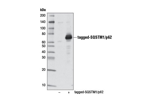  Image 13: SQSTM1/p62-like Receptor Antibody Sampler Kit