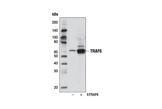  Image 6: TRAF Antibody Sampler Kit