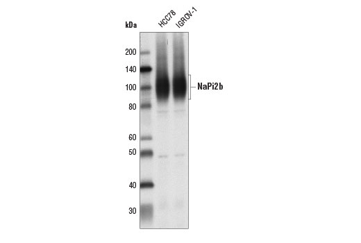 Western Blotting Image 1: NaPi2b/SLC34A2 Antibody