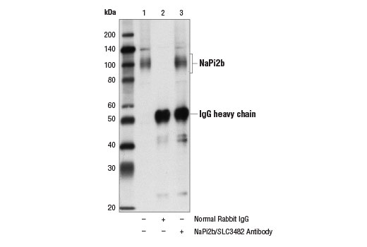 Immunoprecipitation Image 1: NaPi2b/SLC34A2 Antibody